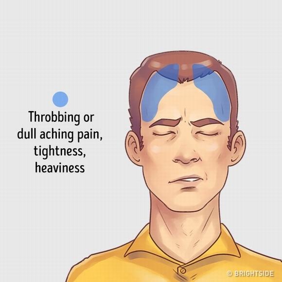 đau đầu, các loại đau đầu, chữa đau đầu