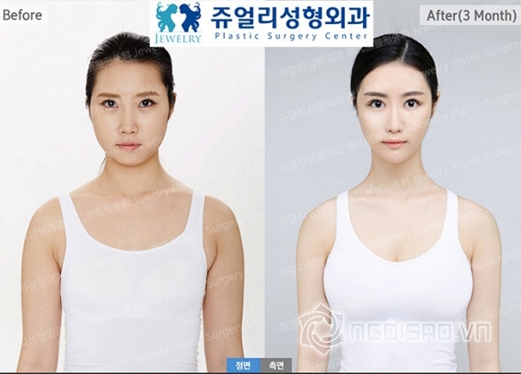 bệnh viên Jewelry, Jewerly Hospital, bệnh viên Jewelry tuyển đại sứ thương hiệu, cơ hội trúng gói làm đẹp 10 tỷ đồng tại bệnh viên Jewelry