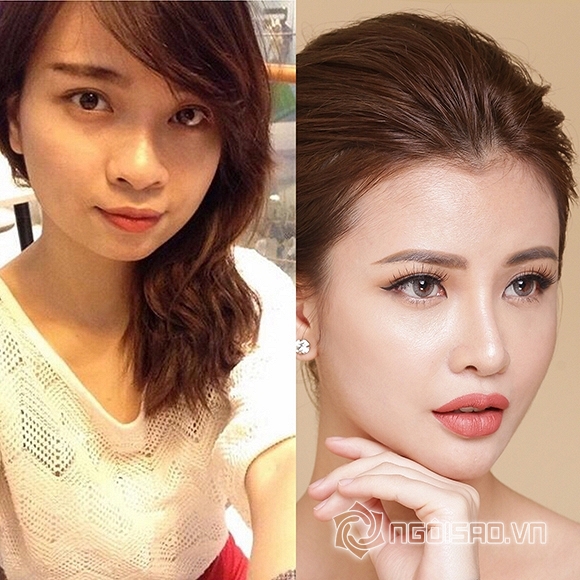 bệnh viên Jewelry, Jewerly Hospital, bệnh viên Jewelry tuyển đại sứ thương hiệu, cơ hội trúng gói làm đẹp 10 tỷ đồng tại bệnh viên Jewelry