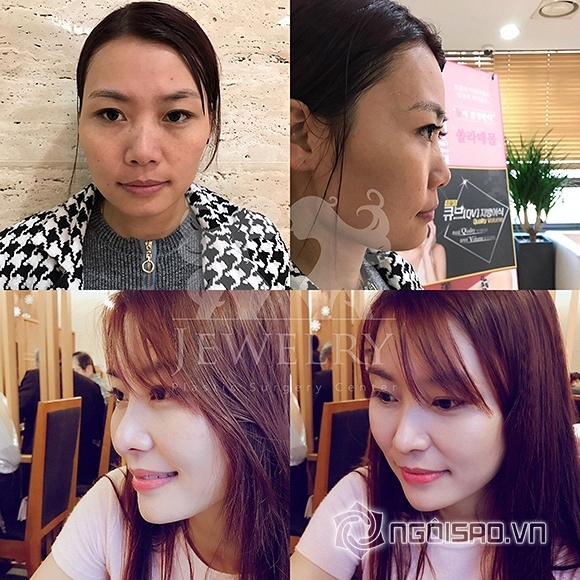 bệnh viên Jewelry, Jewerly Hospital, bệnh viên Jewelry tuyển đại sứ thương hiệu, cơ hội trúng gói làm đẹp 10 tỷ đồng tại bệnh viên Jewelry