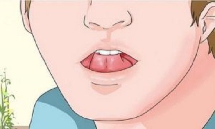lưỡi, cạo lưỡi, vệ sinh lưỡi, vệ sinh lưỡi thường xuyên, cạo lưỡi thường xuyên, vệ sinh răng miệng,  không cạo lưỡi thường xuyên, điều gì sẽ xảy ra nếu bạn không cạo lưỡi thường xuyên
