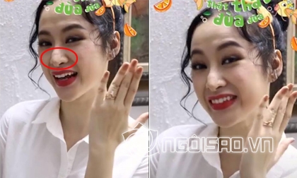 Vũ Thanh Quỳnh, hot girl Nam Định, phẫu thuật thẩm mỹ, hot girl