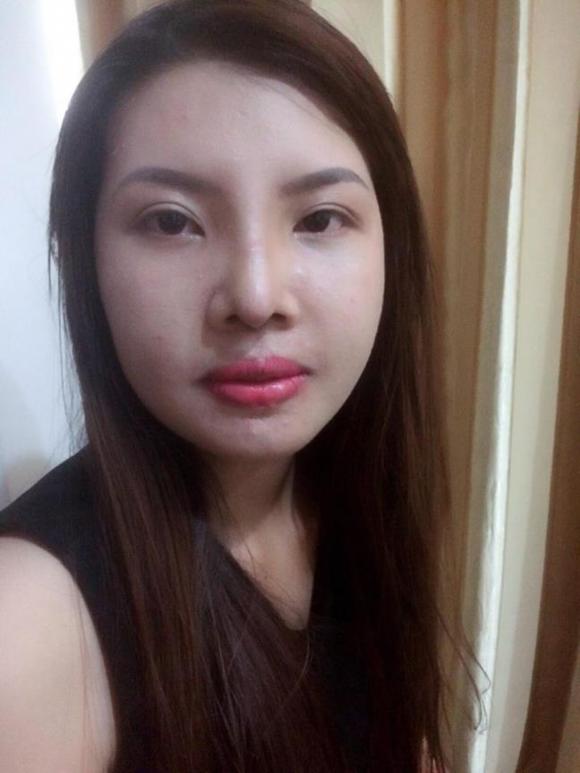 phẫu thuật thẩm mỹ, mẹ đơn thân, mẹ đơn thân phẫu thuật thẩm mỹ, đập mặt đi làm lại, cô gái đập mặt đi làm lại 