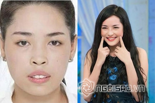 Vũ Thanh Quỳnh, hot girl Nam Định, phẫu thuật thẩm mỹ, hot girl