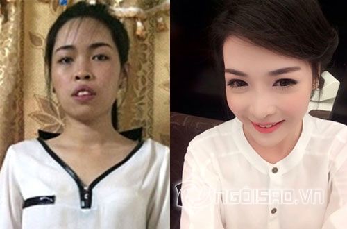 Vũ Thanh Quỳnh, hot girl Nam Định, phẫu thuật thẩm mỹ, hot girl
