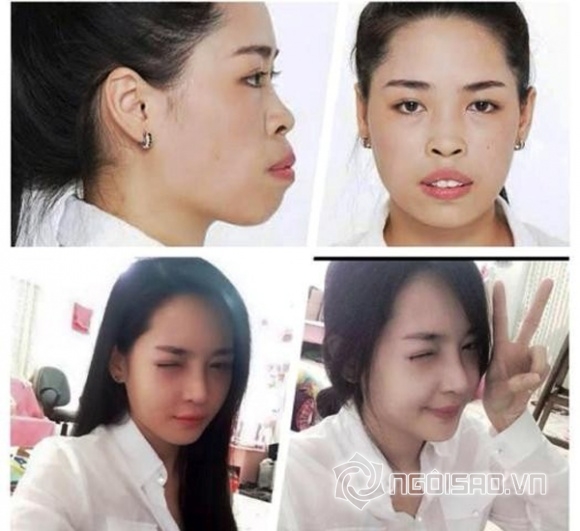 Vũ Thanh Quỳnh, hot girl Nam Định, phẫu thuật thẩm mỹ, hot girl