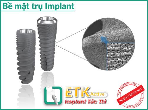 cay-ghep-nha-khoa-114-2-ngoisao.vn-w500-h373 2 Nha Khoa Đông Nam, cấy ghép Implant, Trồng răng
