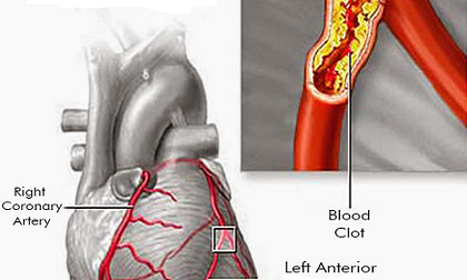 cách làm sạch thớt gỗ thịt, cách làm sạch thớt, làm sạch thớt đơn giản trong 15 phút, làm sạch thớt