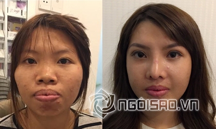 Thị Nở tái sinh, Phượng Single, Kim Phượng, phẫu thuật thẩm mỹ
