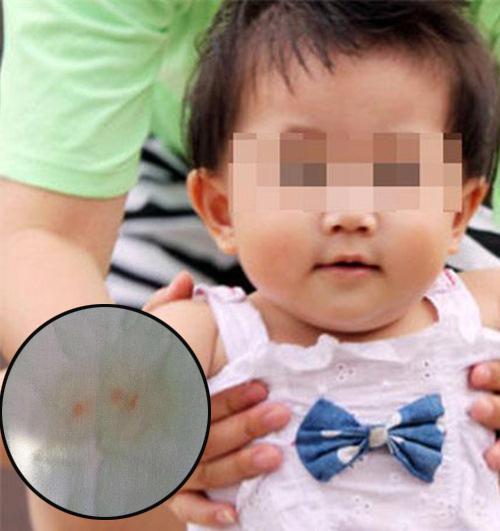 thay tã cho con, trẻ bị xâm hại tình dục, bé gái Trung Quốc nghi bị xâm hại tình dục, chăm con