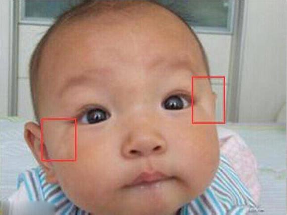 giun tròn, kí sinh trùng, giun tròn trong bụng trẻ em, sức khỏe