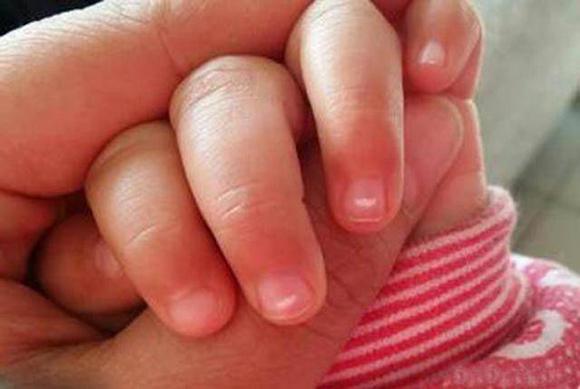 giun tròn, kí sinh trùng, giun tròn trong bụng trẻ em, sức khỏe