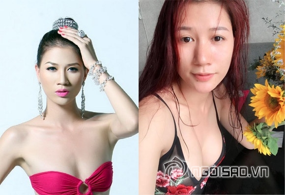 Trang Trần, người mẫu Trang Trần, Trang Trần nâng ngực, Trang Trần phẫu thuật thẩm mỹ