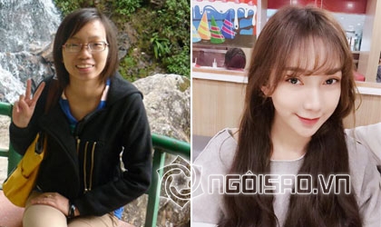 Thị Nở tái sinh, Phượng Single, Kim Phượng, phẫu thuật thẩm mỹ