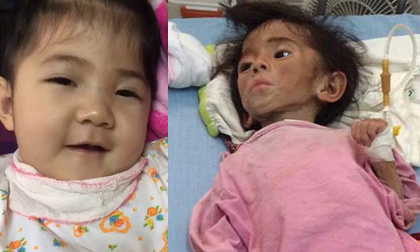 Thào Thị Yến Nhi, bé gái Lào Cai 14 tháng tuổi nặng 3,5kg