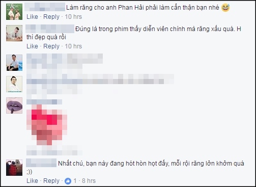 nam diễn viên Việt Anh, Phan Hải - 'Người phán xử', sao Việt, Việt Anh sửa răng