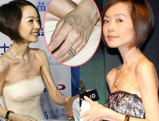 sao Hoa ngữ,mỹ nhân Hoa ngữ,mỹ nhân Hoa ngữ gầy trơ xương,mỹ nhân Hoa ngữ giảm cân