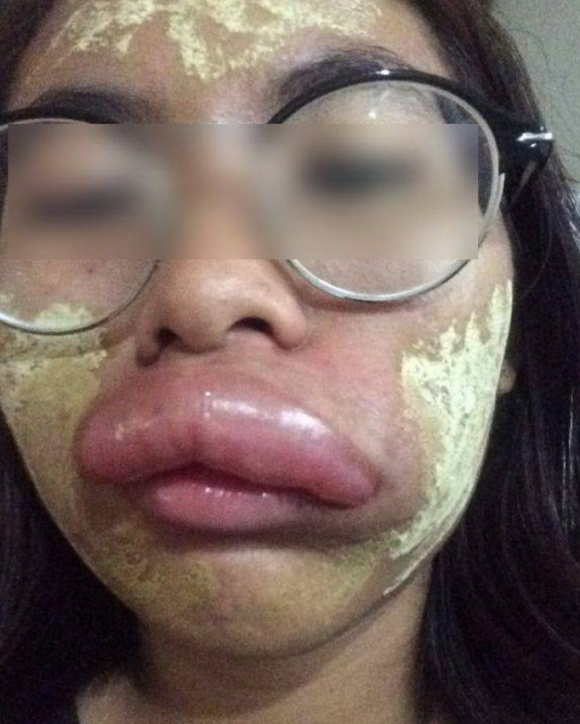 cô gái trẻ nhận cái kết bất ngờ, điều khiển xe máy không đội mũ bảo hiển, mũ bảo hiểm