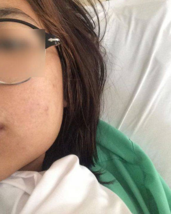 cô gái trẻ nhận cái kết bất ngờ, điều khiển xe máy không đội mũ bảo hiển, mũ bảo hiểm