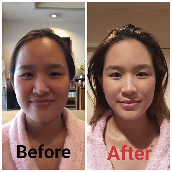 giam-can-khong-phau-thuat-67-10-ngoisao.vn-w580-h580 0 Nghệ nhân Tajima Midori, Phương pháp điêu khắc vóc dáng vận dụng khí công