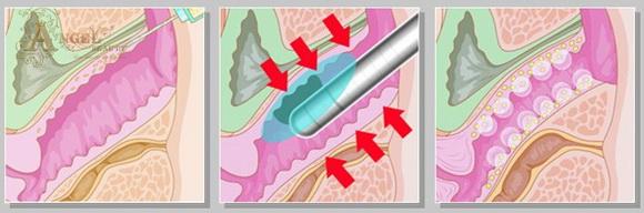 lam-dep-vung-kin-127-4-ngoisao.vn-w580-h192 1 làm đẹp vùng kín, Bí quyết làm đẹp, Làm đẹp sau sinh