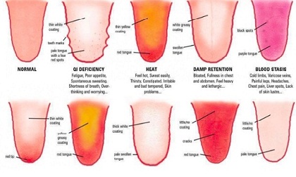 phối màu cho ngôi nhà, thiết kế nội thất, sai lầm thiết kế nội thất