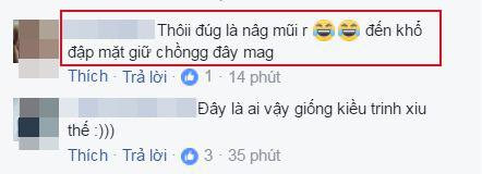 sao việt, hari won, hari won thẩm mỹ, hari won mặt khác lạ, vợ trấn thành 