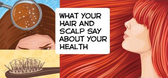 tóc, biểu hiện của tóc, đoán bệnh qua biểu hiện của tóc, tóc có gàu, tóc mỏng, tóc khô,chăm sóc sức khỏe