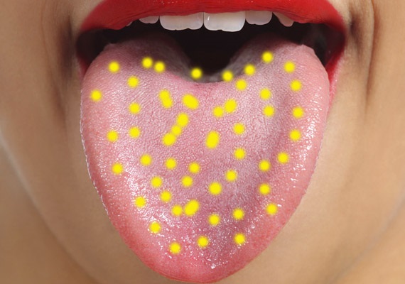 nấm Candida, nấm sinh dục, nhiễm nấm sinh dục, nhiễm nấm, nhiễm nấm Candida, bài kiểm tra nhiễm nấm, nhổ nước bọt vào cốc nước,chăm sóc sức khỏe