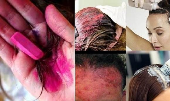 Nhuộm tóc gây ung thư - Đừng lo lắng về nhuộm tóc gây ung thư nữa! Hãy xem hình ảnh liên quan để có thể hiểu rõ hơn về vấn đề này. Chúng tôi sẽ giải đáp mọi thắc mắc của bạn và cung cấp những thông tin hữu ích để bạn có thể yên tâm khi nhuộm tóc.