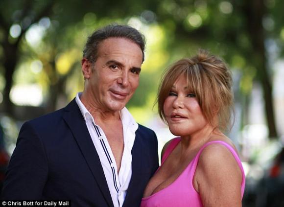 thảm họa dao kéo Mỹ,Jocelyn Wildenstein,Lloyd Klein