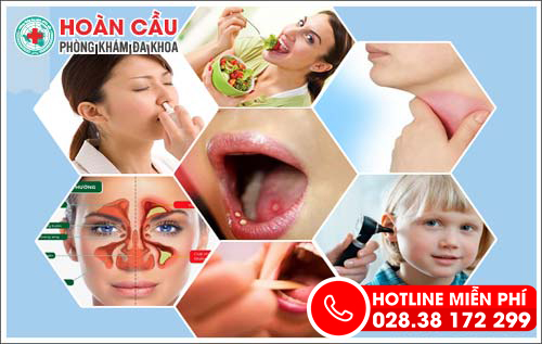 tai-mui-hong-612-1-ngoisao.vn-w500-h317 1 phòng khám tai mũi họng, khám tai mũi họng, Phòng khám đa khoa Hoàn Cầu