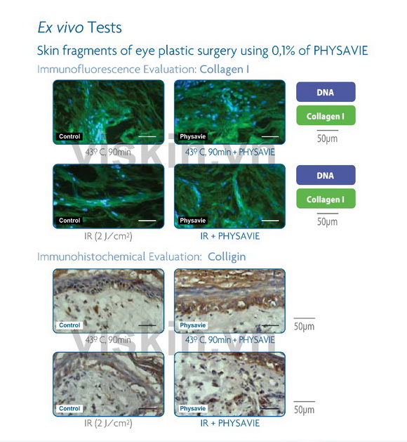 kem-viskin-191-2-ngoisao.vn-w580-h629 3 mỹ phẩm ViSkin, Kem dưỡng phục hồi da Viskin