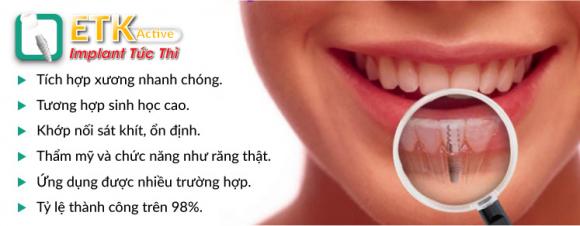 nha-khoa-dong-nam-241-3-ngoisao.vn-w747-h292 4 cấy ghép răng ETK Active, Nha Khoa Đông Nam, cấy ghép răng Implant