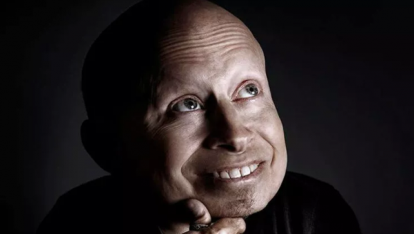 Sao Harry Potter, verne troyer, sao hollywood