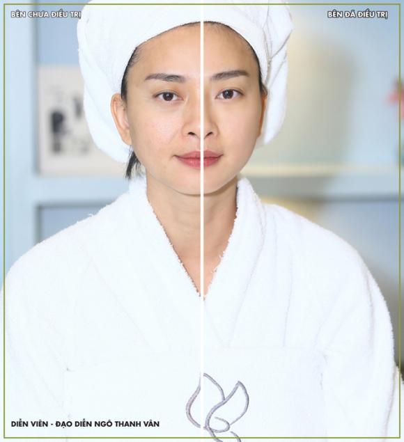 Ngô Thanh Vân, BB Thanh Mai, Trẻ hóa da