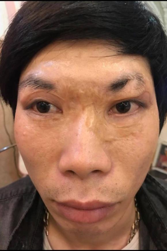 Phượng Hồng Kông, Thẩm mỹ Hồng Kông, Phun xăm thẩm mỹ