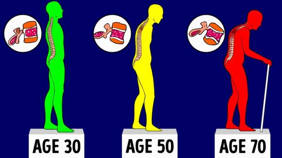 loãng xương, nguyên tắc bảo vệ xương, nguyên tắc bảo vệ xương khỏe mạnh