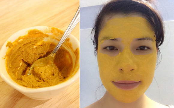 Trị mụn, Thẩm mỹ Hồng Kông, công nghệ trị mụn hiệu quả, Trị mụn công nghệ cao