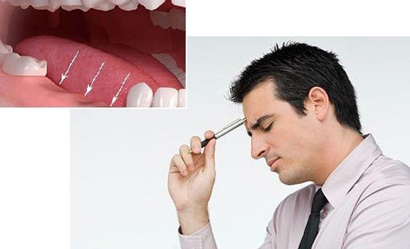 trồng răng Implant, Nha Khoa Đông Nam, Phòng khám răng uy tín