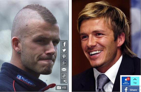 David Beckham,Beckham cấy ghép tóc,Beckham bị hói