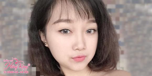 Phun thêu thẩm mỹ, Thẩm mỹ hồng kông, Tô thị phượng