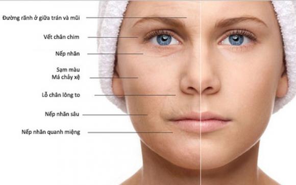 BB Thanh Mai,MC Thanh Mai,trẻ hóa da