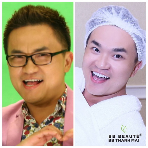 bb-thanh-mai-2911-2-ngoisao.vn-w500-h500 8 BB Thanh Mai, Trẻ hóa da, MC Thanh Mai