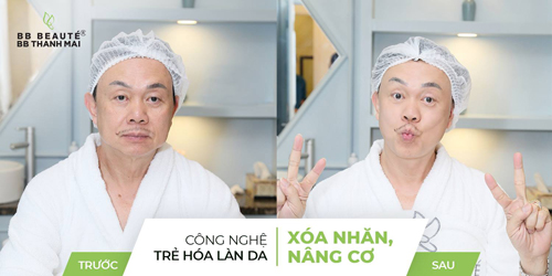 chi-tai-1312-ngoisao.vn-w500-h250 0 BB Thanh Mai, Trẻ hóa da, MC Thanh Mai