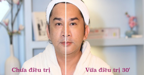 bb-thanh-mai-1812-9-ngoisao.vn-w500-h262 0 BB Thanh Mai, Trẻ hóa da, MC Thanh Mai