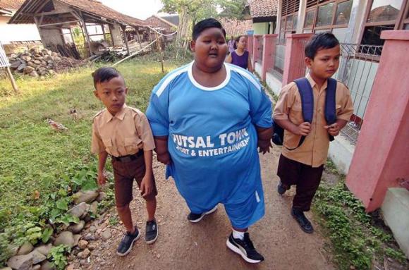cậu bé béo nhất thế giới,cậu bé nặng 200kg ở Indonesia