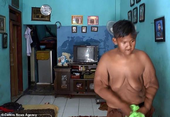 cậu bé béo nhất thế giới,cậu bé nặng 200kg ở Indonesia