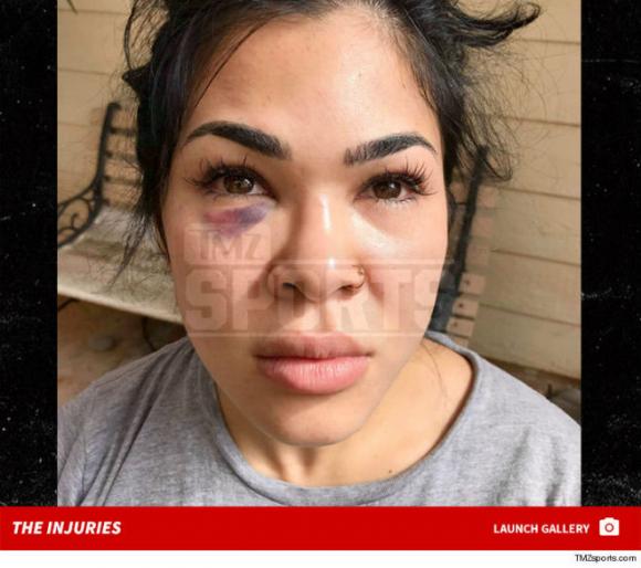 võ sỹ UFC, nữ võ sĩ bị chồng đánh, nữ võ sĩ bị chồng hành hung