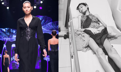 Người mẫu Việt bị ung thư, Nguyễn Kim Anh, sao việt